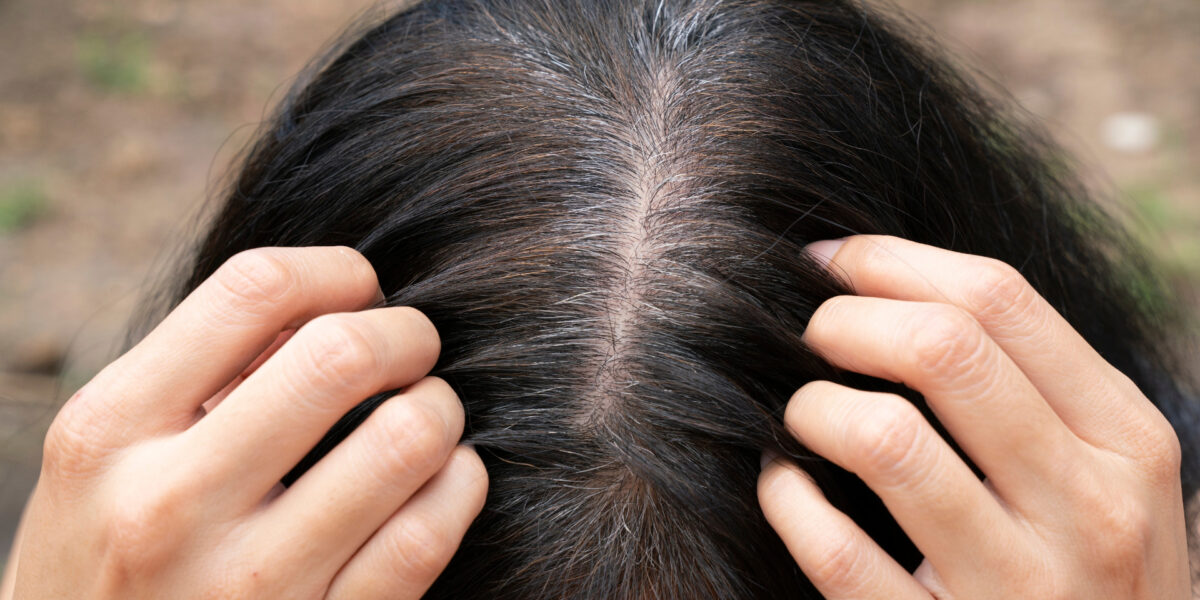 Bekommt Man Graue Haare Im Intimbereich