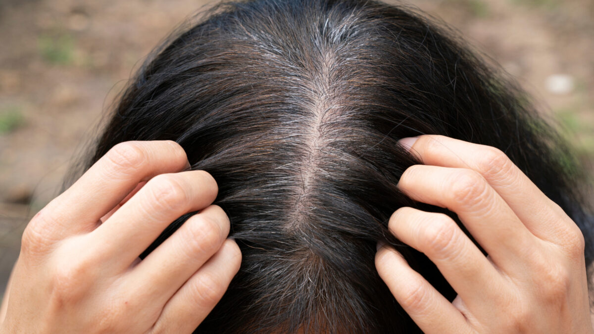 Ab wann graue Haare? Ursachen und Tipps gegen das Ergrauen