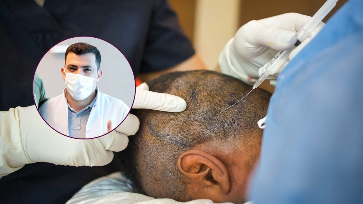Klinik für die Haartransplantation in der Türkei führt den BIO Power Boost ein 