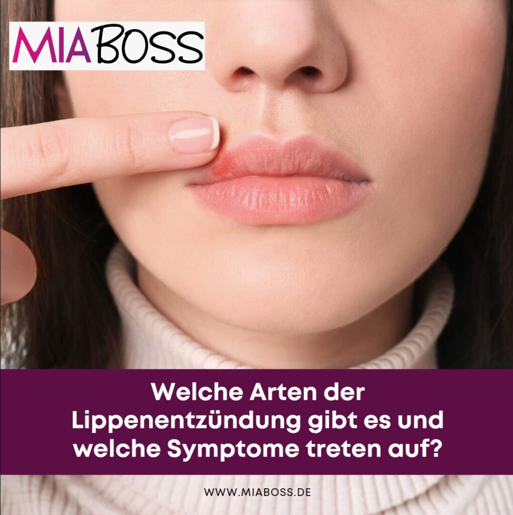 lippenentzündung arten und symptome
