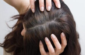 Grauen Haaransatz kaschieren: Tipps und Tricks für einen natürlichen Look