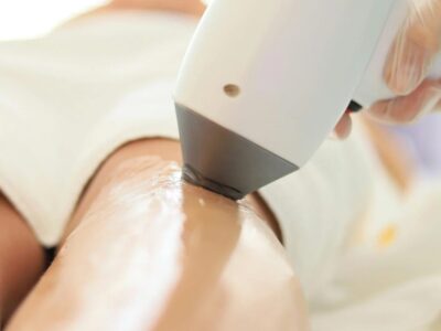 Laser-Haarentfernung in Berlin