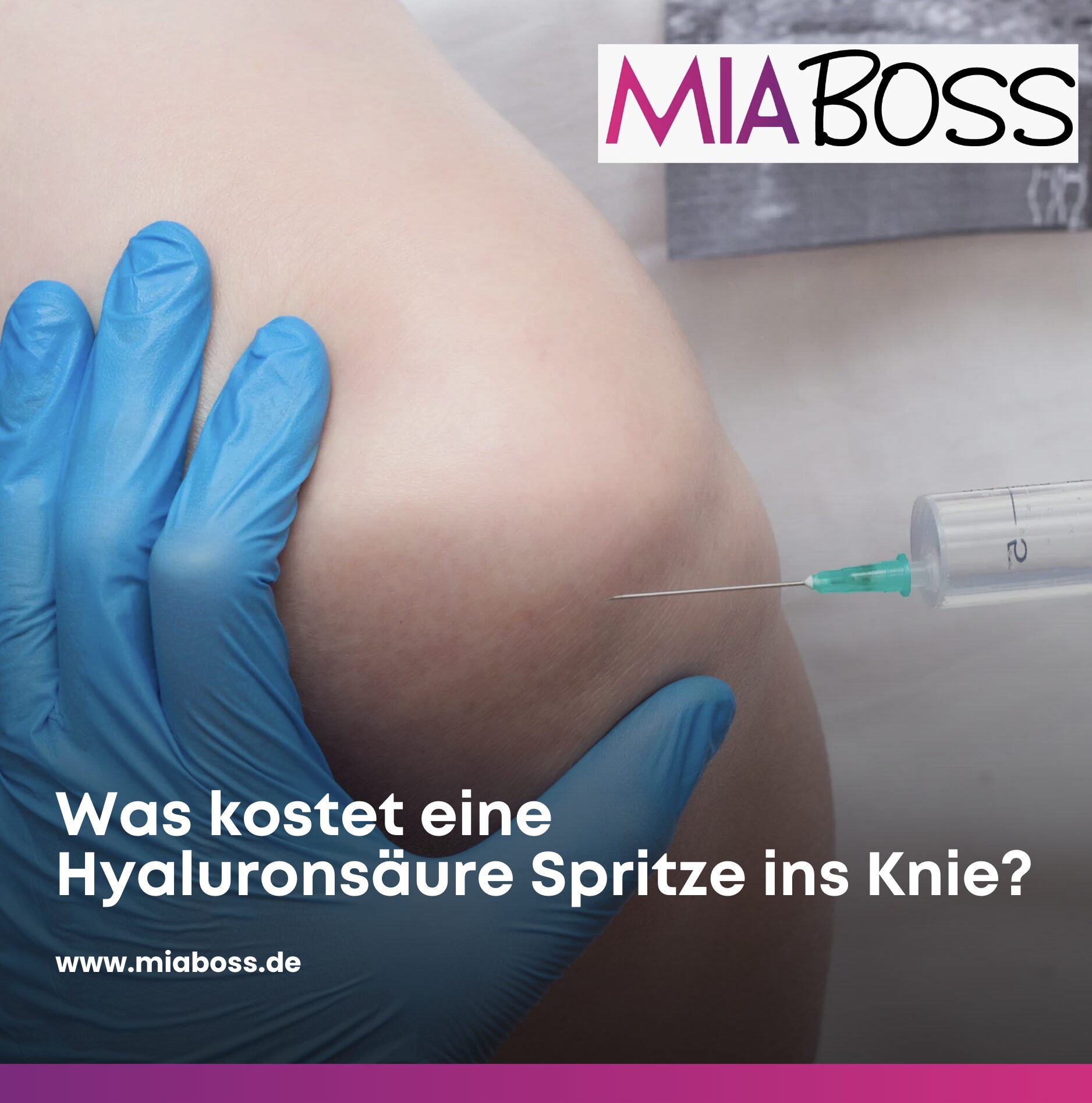 Was kostet eine Hyaluronsäure Spritze ins Knie? Was kostet eine Hyaluronsäure Spritze ins Knie?