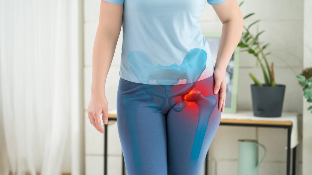 Was sind Hip Dips Anatomie der Hüfte und Wege zum Verändern