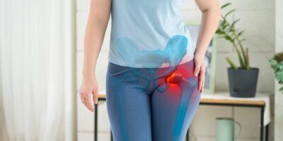 Was sind Hip Dips Anatomie der Hüfte und Wege zum Verändern